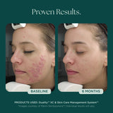 Duality XC | Jan Marini | Marini Skin Solutions - theskinward