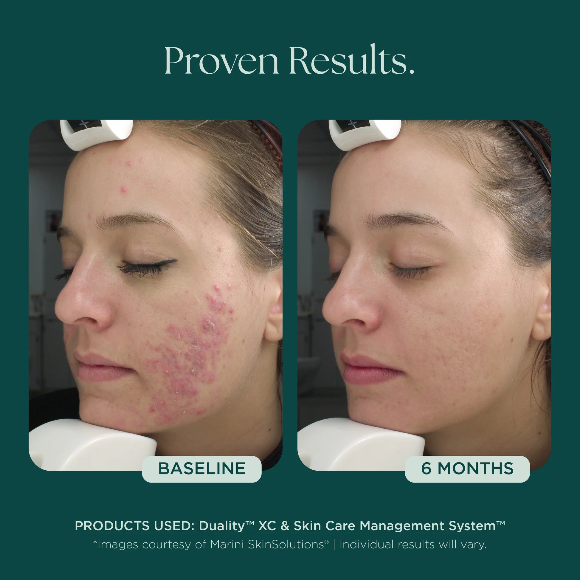 Duality XC | Jan Marini | Marini Skin Solutions - theskinward