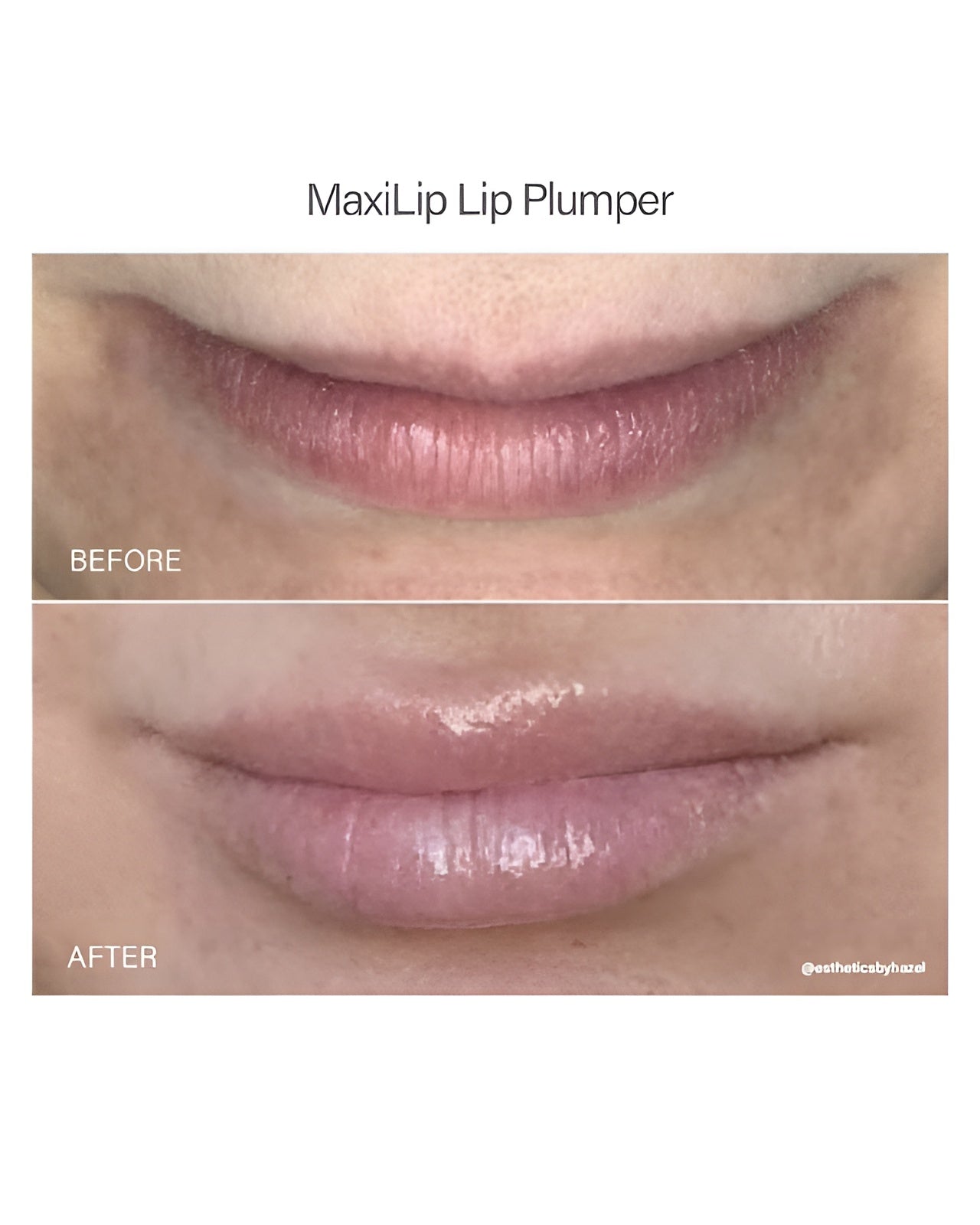 Vivant Maxi - Lip - theskinward